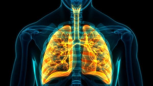 ***SIGNS AND SYMPTOMS Chronic lung diseases can cause the following signs and symptoms:***Treatment***Why Scigenomics?